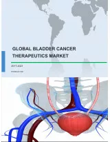 Global Bladder Cancer Therapeutics Market 2017-2021